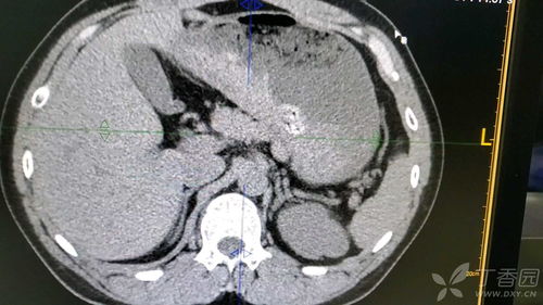青柠桌面官方下载和天书奇谭激活码,精准解答解释定义-CT_v5.961